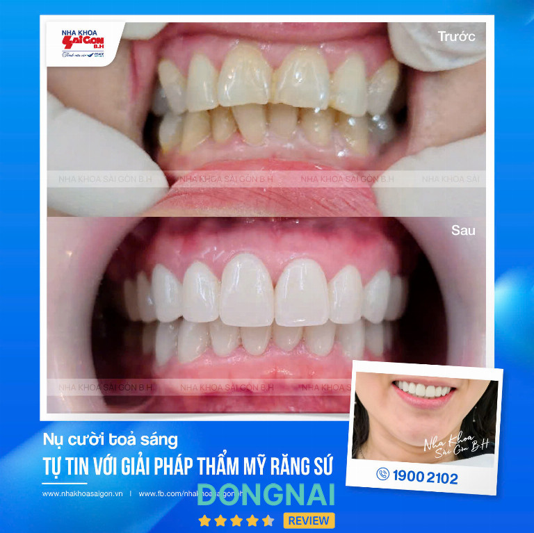 Nha Khoa Sài Gòn B.H