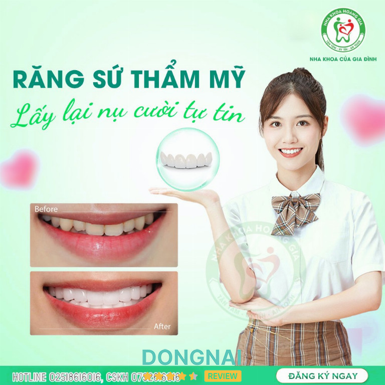 Nha Khoa Hoàng Gia Biên Hòa