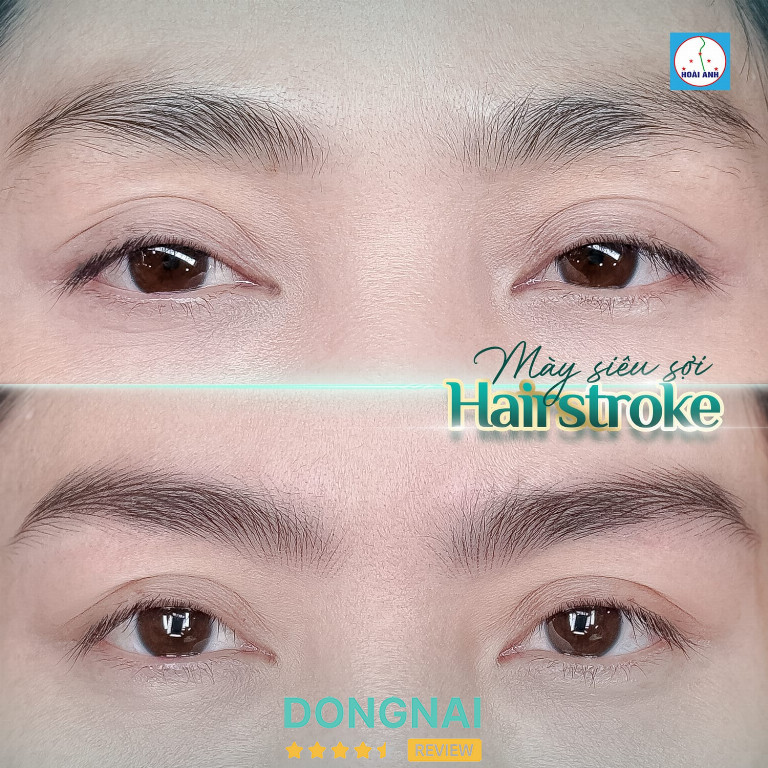 Thẩm Mỹ Viện Hoài Anh