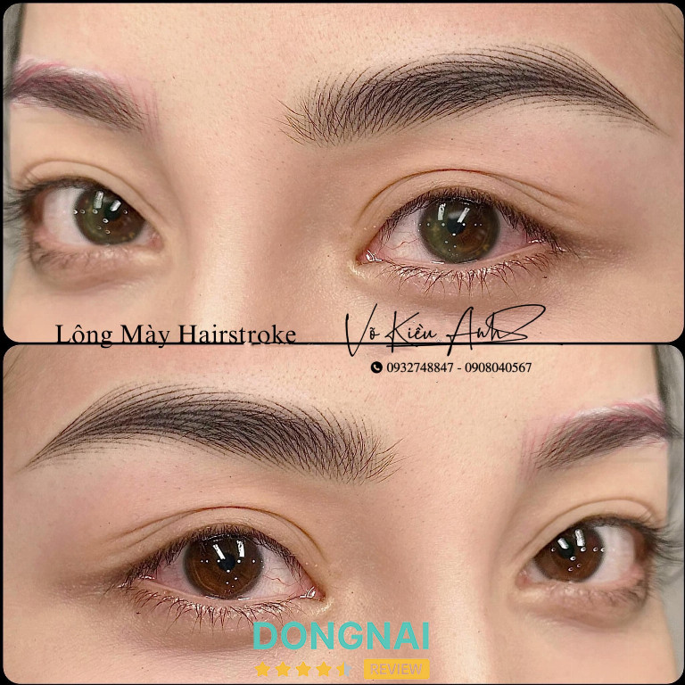 Thẩm Mỹ Viện Kiều Anh