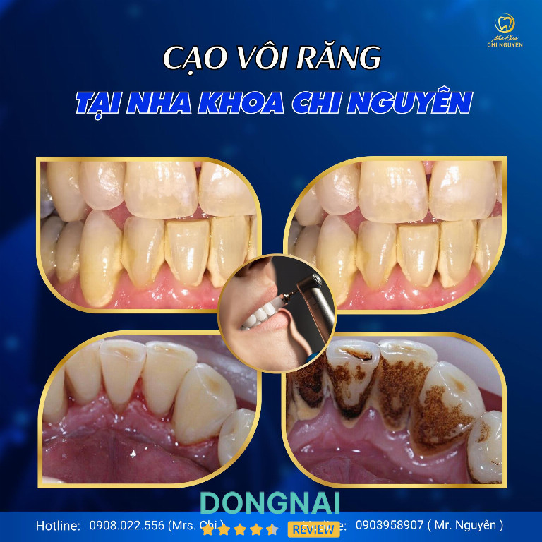 Nha Khoa Chi Nguyên - 80/1, KP. 6