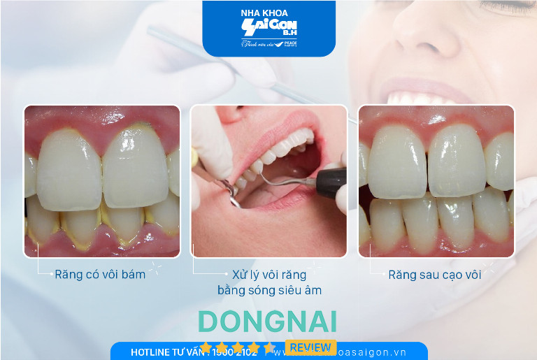 Nha Khoa Sài Gòn B.H - 1387 Nguyễn Ái Quốc
