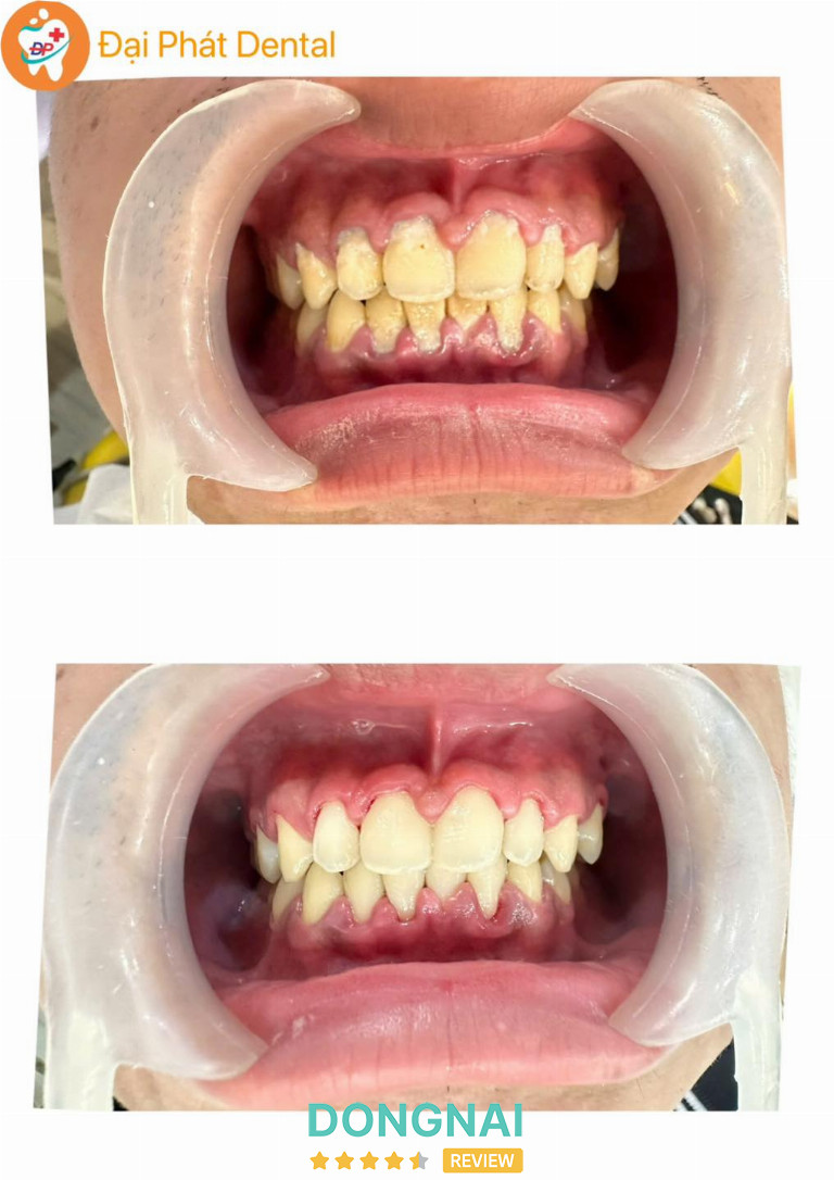 Nha Khoa Đại Phát - 371 Phạm Văn Thuận