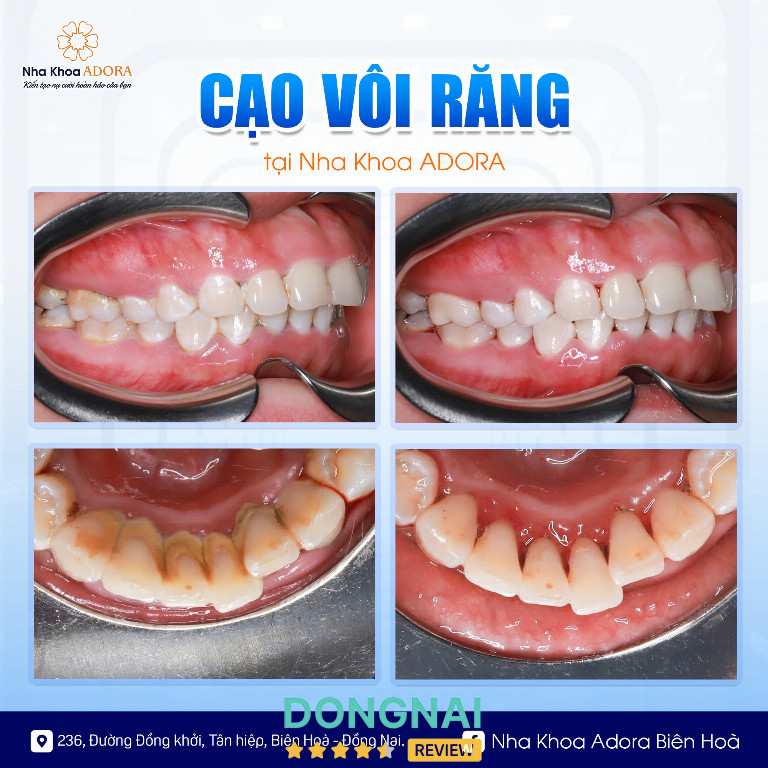 Nha Khoa ADORA Sài Gòn - 236 Đường Đồng Khởi