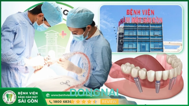 quy trình trồng răng Implant tại Bệnh Viện Răng Hàm Mặt Sài Gòn